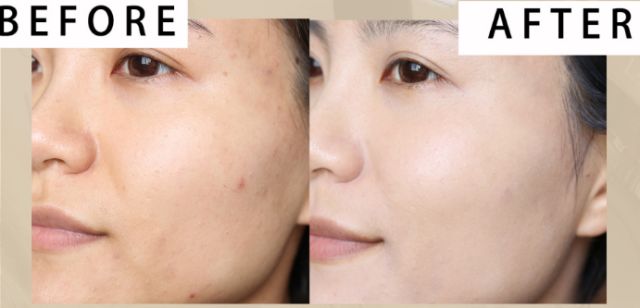 戚薇改版,戚薇变脸抖音