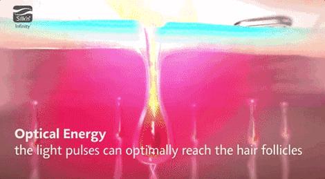 头发根部变白然后脱落,头发慢慢变白怎么办