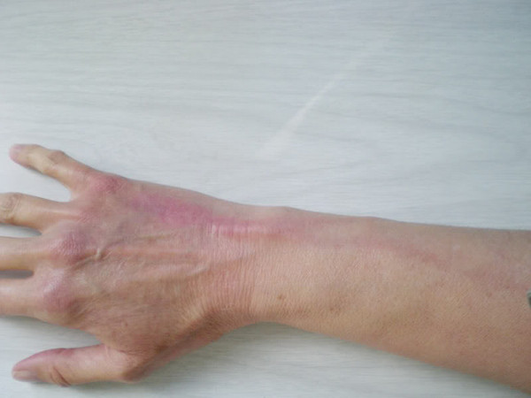 输液时注意事项动画版,输液时有件事千万别做