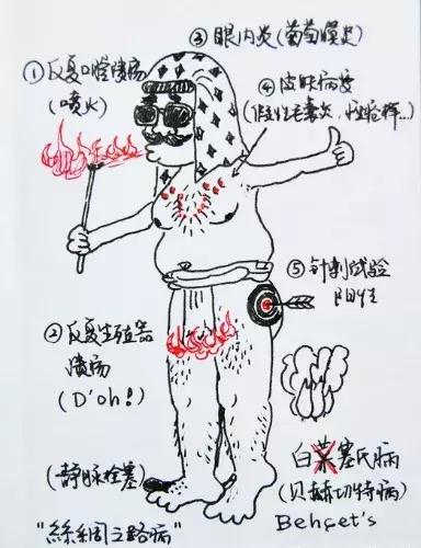 口腔溃疡经常反复去医院该查什么,口腔溃疡反复发作一招解决