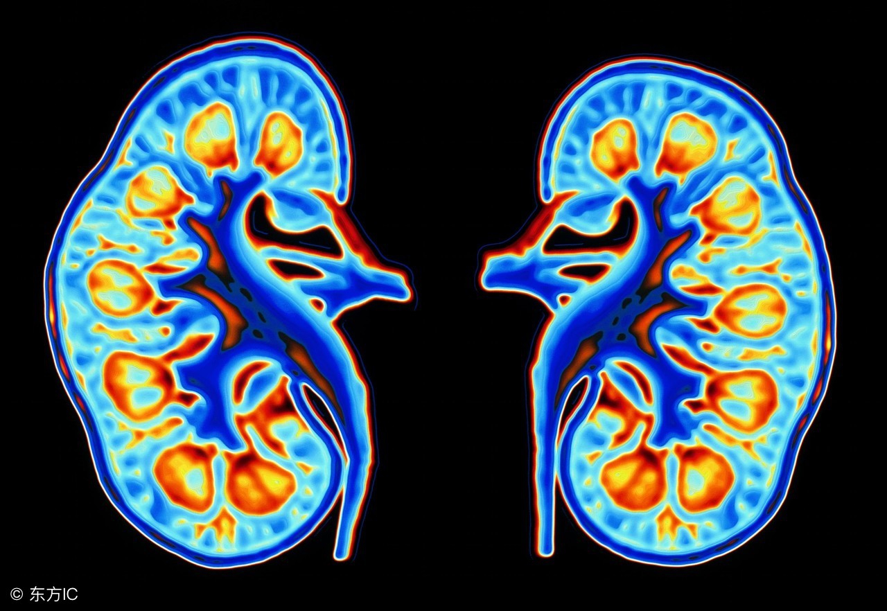 肾衰竭菠萝能吃吗,菠萝肾衰竭可以吃吗