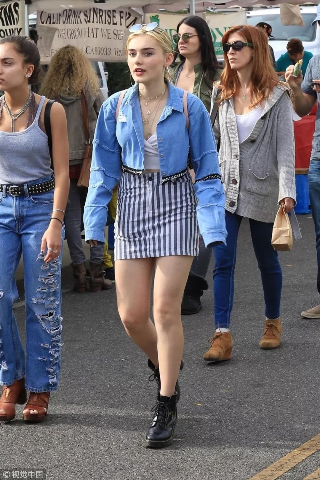 腿上长竖着的条纹,腿上长竖条纹