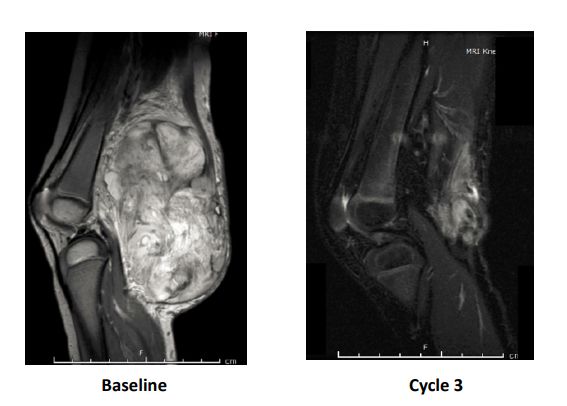 神奇制药抗癌专利,神奇制药抗癌药取得突破