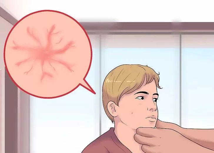 肝癌初期身体的四个症状藏不住,不痛不痒的肝癌是良性还是恶性