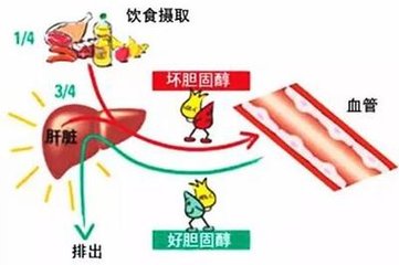 降胆固醇，抗血小板——冠心病的基础治疗