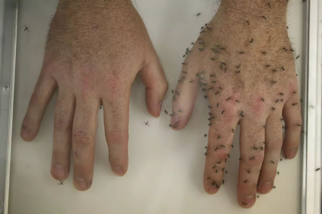 户外溜达一圈回来身上痒怎么办,出门一趟回来浑身痒