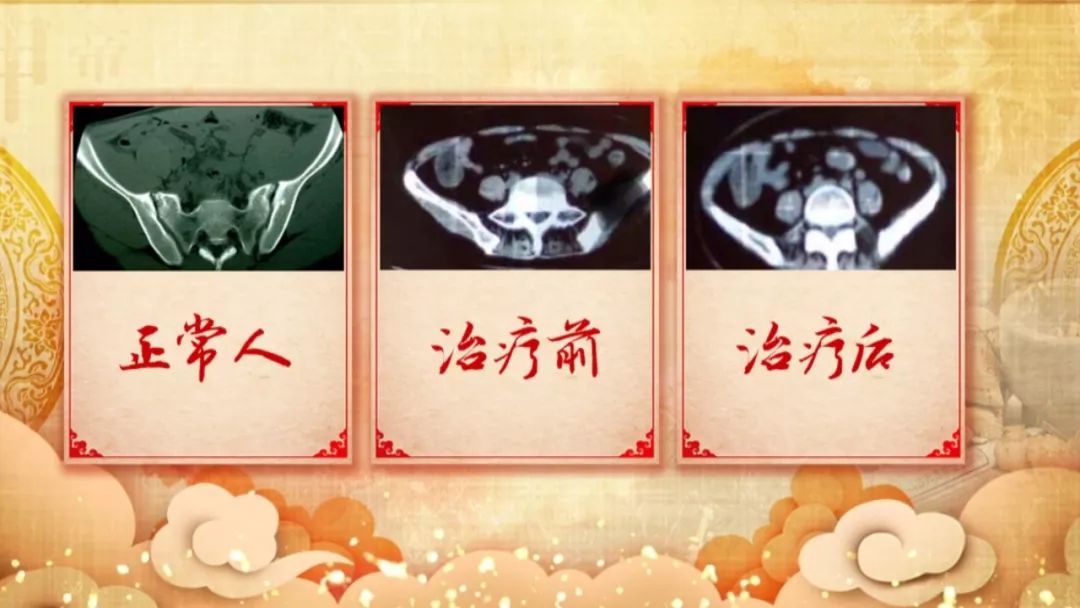 养生堂中医看病全集,养生堂2023.11.7全集免费