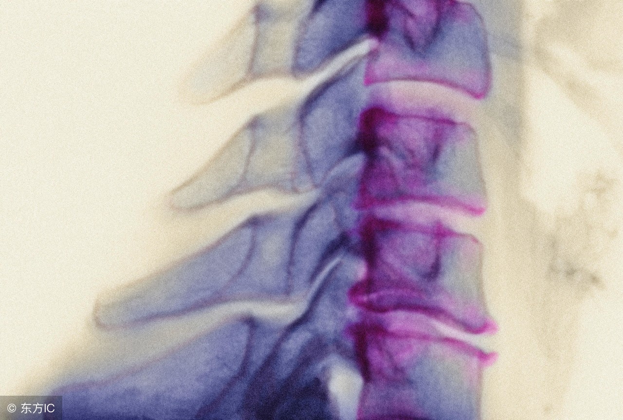 膝盖处骨刺最好的医疗方法是什么,请问专业的医生骨刺怎么处理呢