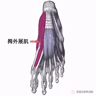 拇外翻该怎么办,拇外翻的解决方法