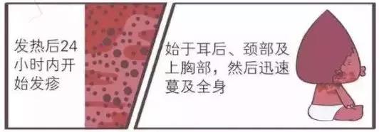 手足口病的病毒类型有地区差异吗,没有疫苗的手足口病有哪些症状