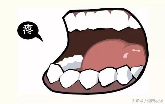 牙疼上火了吃什么中药好得快,白芷细辛三味中药治疗牙疼