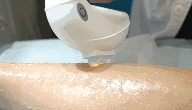 天津小白楼的神店！脱毛后瞬间白2度，原来女神夏天都……