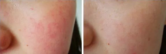 雅诗兰黛密集修护面膜和sk2面膜,雅诗兰黛专柜面膜