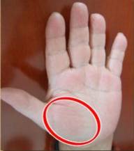 手健康有多重要,手型看健康