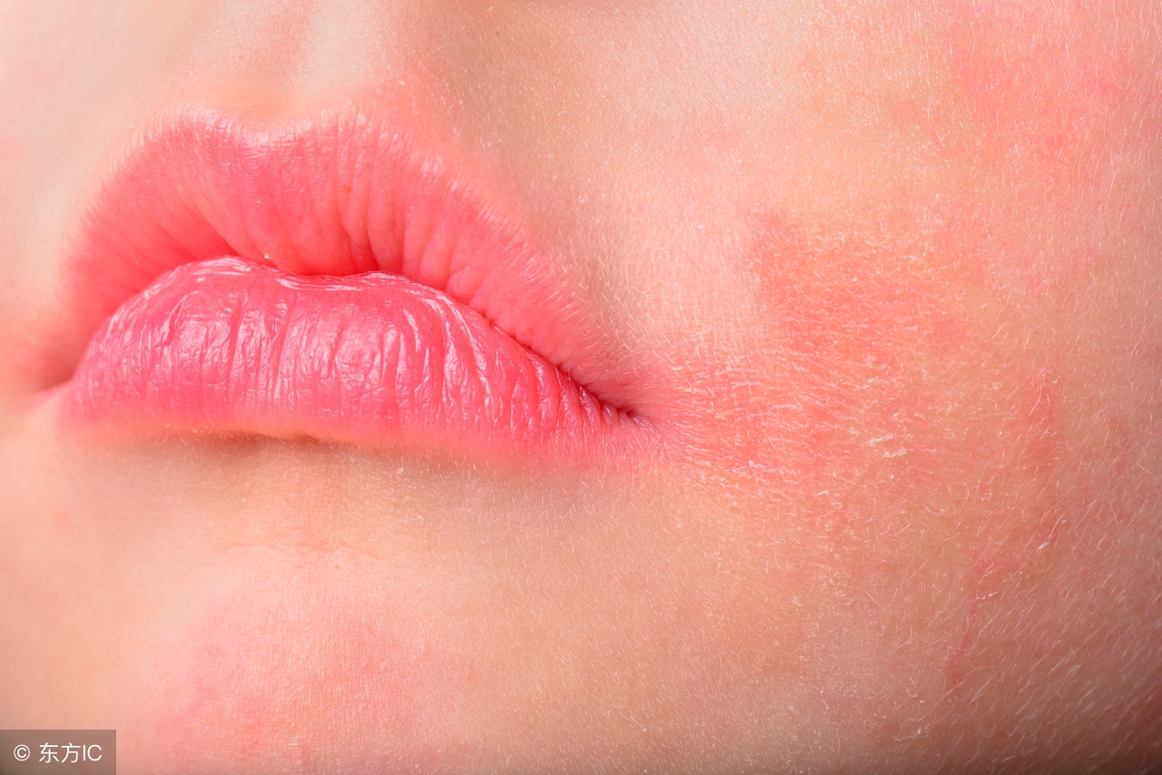 科普｜敏感肌自救指南