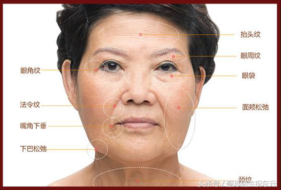 脸部肌肉下垂怎样变得紧致医美,脸部肌肉下垂怎么办