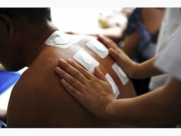 我院中西医结合科“冬病夏治”开始啦！