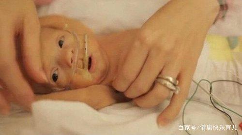 早产宝宝肠绞痛症状表现及护理,孩子早产怎么安慰爸爸妈妈