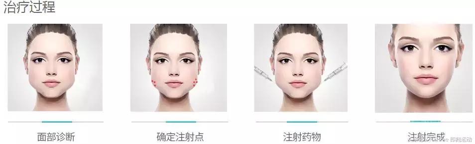 张雨绮刮痧瘦脸方法视频,张雨绮脸在哪做的超声刀