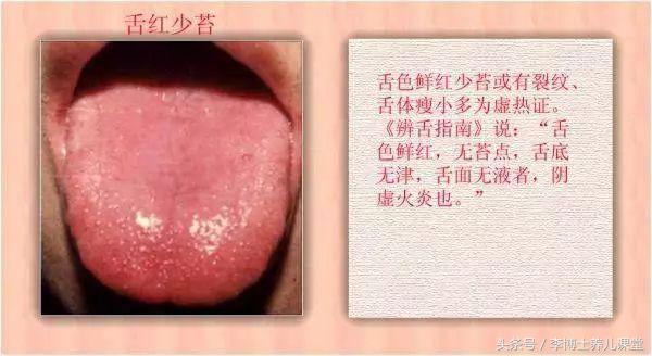 为什么宝宝出汗特别多,为什么宝宝满头汗