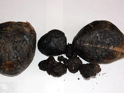 世界上十大最毒知识,毒相关知识