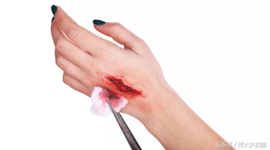 被铁哥们亲了一口，医生竟让我打破伤风？