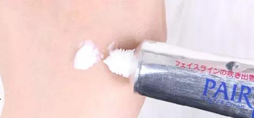 困扰好几年的痘痘终于好了,困扰多年痘痘终于好了