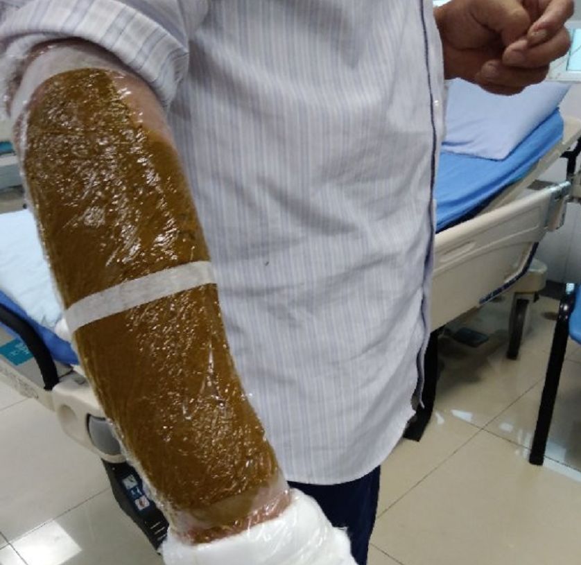 自家别墅花园有蛇什么原因,深圳一别墅区惊现蛇出没