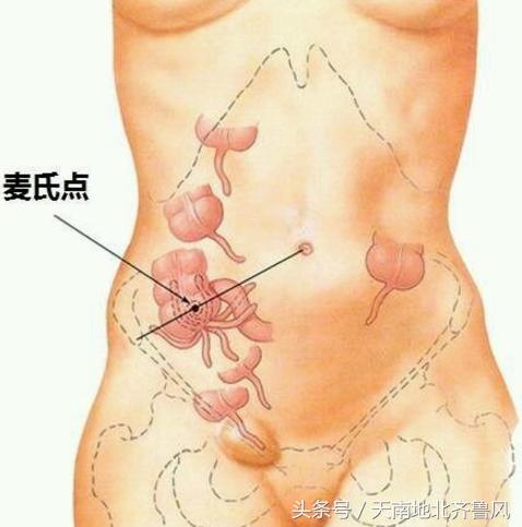 孩子腹痛当心急性阑尾炎,小孩发烧小腹部隐痛可要当心了