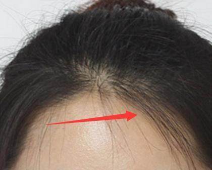 碎发多怎样才能让碎发变好看,超短碎发怎么补救女生