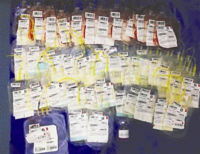 最新孕妇大出血抢救后续,孕妇大出血抢救后续