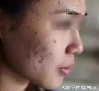 你用的面膜真的安全可靠吗,你用的面膜上榜吗