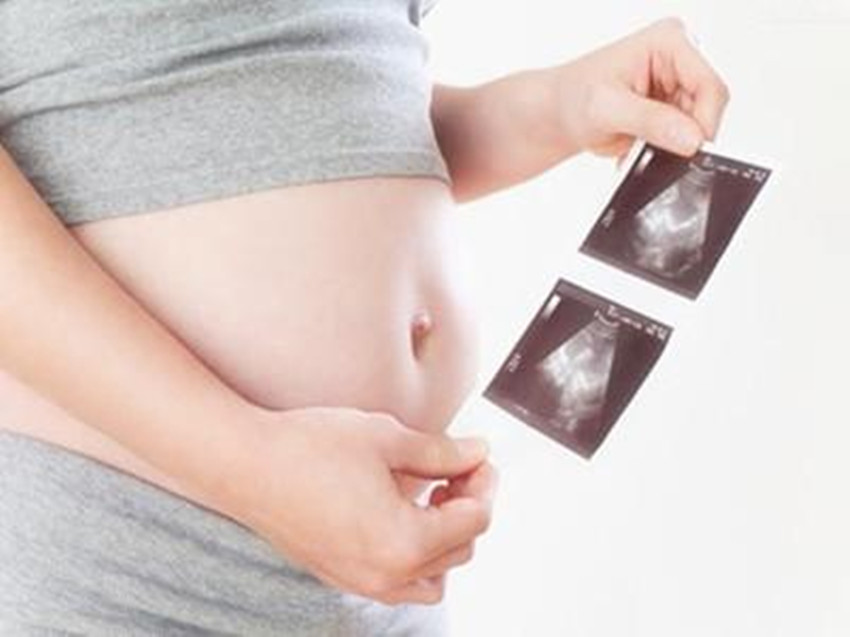 做四维彩超前，准妈妈应该做些什么准备，才能让检查顺利呢