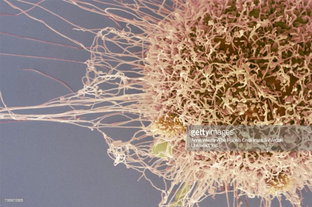 这些细胞害死了主人之后，又在实验室里繁殖了18000代