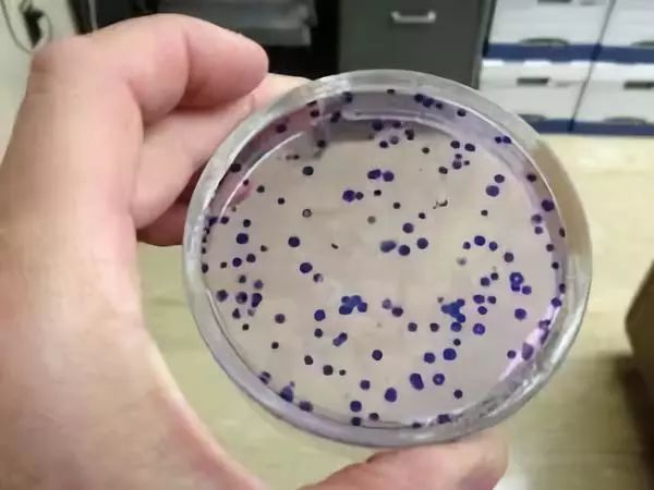 这些细胞害死了主人之后，又在实验室里繁殖了18000代