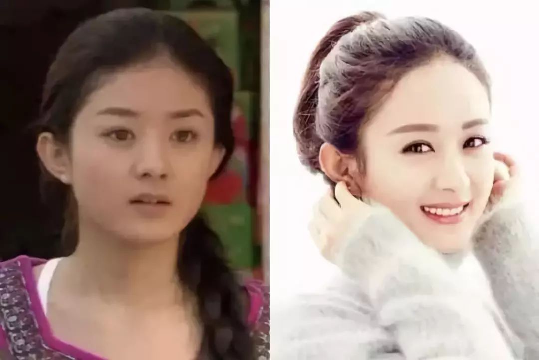 发际线太高显老这些神器了解一下,发际线不好看自己怎么弄