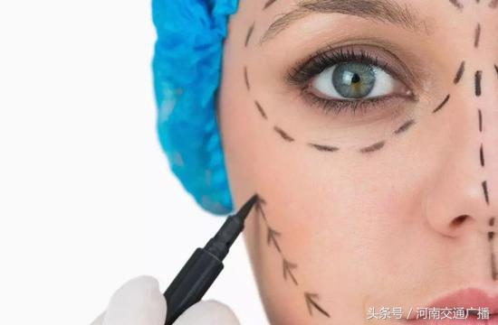 女子整容鼻子凹下去了,女子整容整个脸变毁容不敢出门