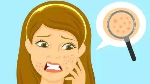 让毛孔变小最快的方法学生,让毛孔变小用什么药