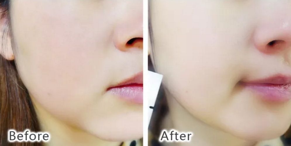 冰岛面膜好物推荐,深海白珍珠面膜