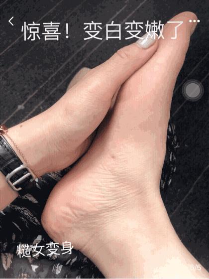 擦掉一张皮，双脚换皮术！死皮、老茧一喷就没，15秒还原嫩白玉足