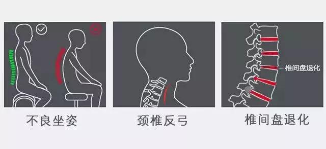 护着脖子的枕头,护住颈椎的东西