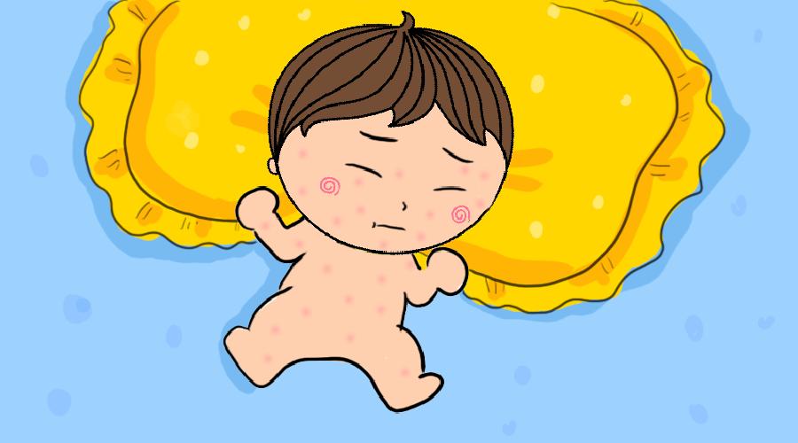 如何通过日常护理来预防湿疹复发,宝宝湿疹大人怎么办