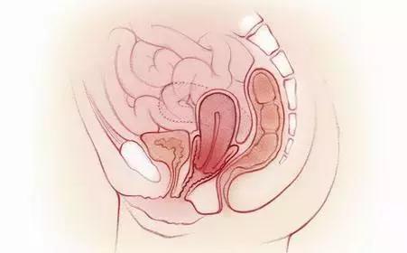 29岁女士竟然尿湿裤子，专家说我国有三成女性患有此病！
