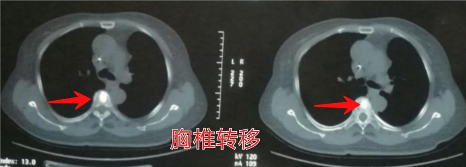 除了靶向免疫还有别的方法吗,除了靶向药还有什么方法治疗
