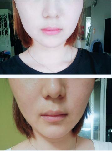 瘦脸不瘦的方法,瘦脸不动刀最有效的方法