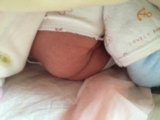 宝宝的脸上起了小红点是怎么回事,宝宝屁股上起了点小红点点