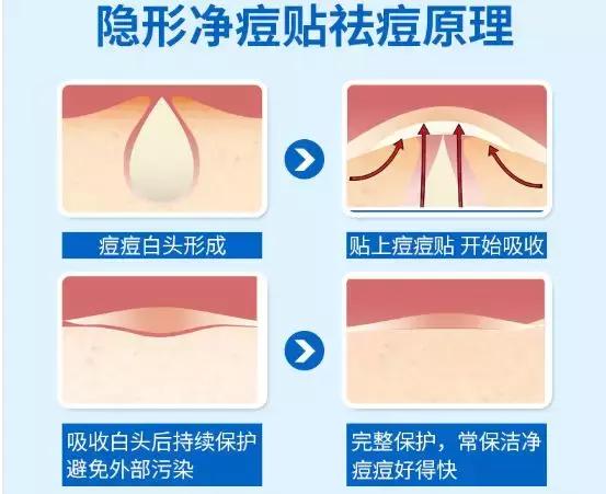 祛痘上万次的皮肤测试,十大公认祛痘印效果最好的产品