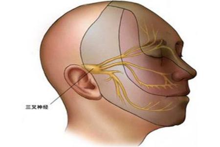 脸偶尔针扎一样疼一下,三叉神经痛脸痛在中医上怎么讲