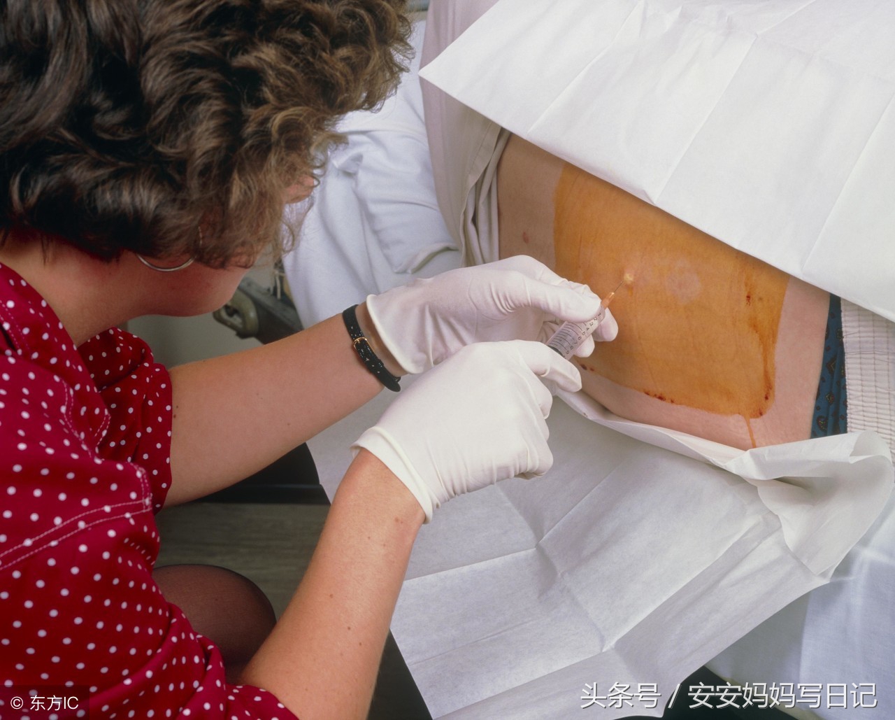 剖腹产后会有哪些并发症,剖腹产后痛有什么更好的方法