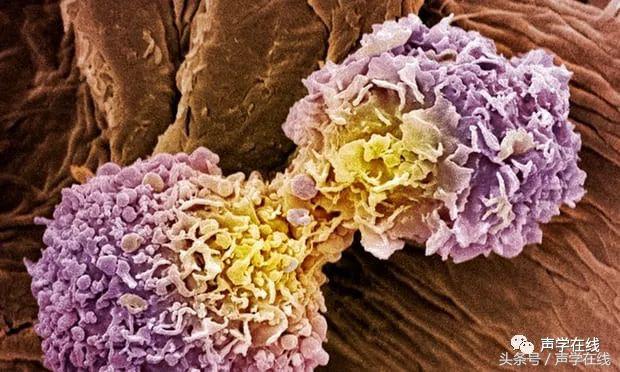 ai能战胜癌症吗,我不是药神惹怒众多癌症患者